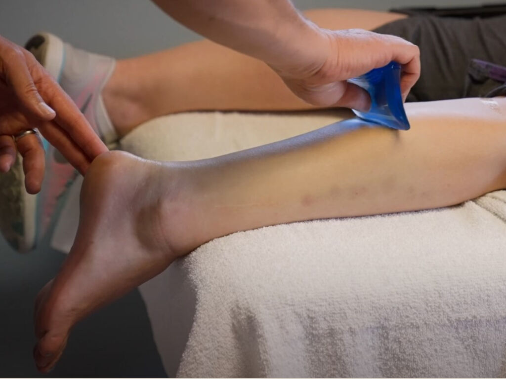 physical therapist uses ASTYM tool on a patient's calf