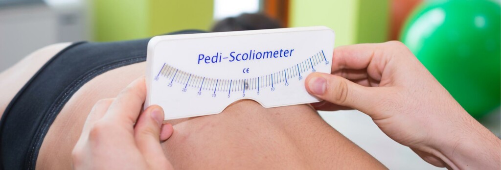 measuring degree of curve in adolescent scoliosis
